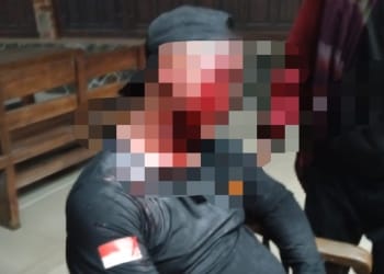 anggota linmas jepara dikeroyok saat amankan hajatan hingga luka parah