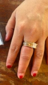 Foto Cincin di jari seorang wanita Pakisaji Jepara yang tidak bisa dilepas